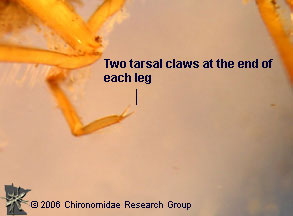 Dytiscid larva tarsal claw