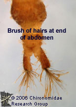 Hydropsychidae brush hairs