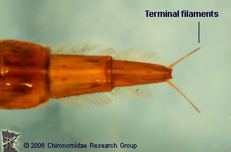 Dytiscid larva terminus