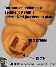 Glossosomatidae anal legs