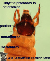 Glossosomatidae thorax
