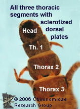 Hydropsychidae thorax