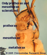 Leptoceridae thorax