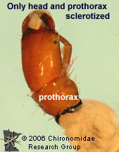 Philopotamidae thorax
