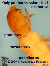 Polycentropodidae thorax