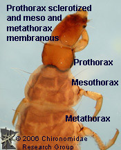 Rhyacophilidae thorax