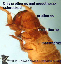 Uenoidae thorax